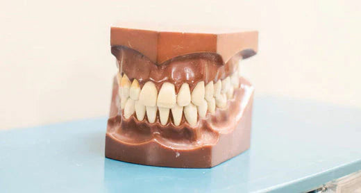Gros plan d'un modèle dentaire présentant un ensemble de dents droites.