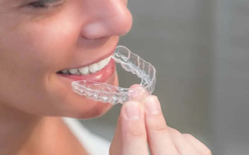 retainers.