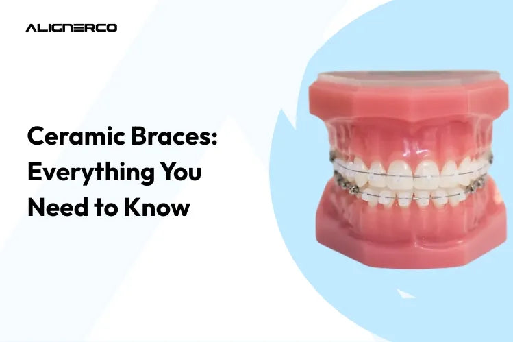 Appareil dentaire en céramique sur un modèle de dents