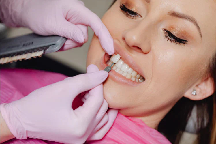 Un dentiste applique une facette dentaire sur un patient