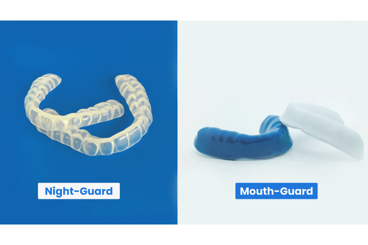 Image comparative d'une gouttière nocturne et d'un protège-dents sur fond bleu et blanc.