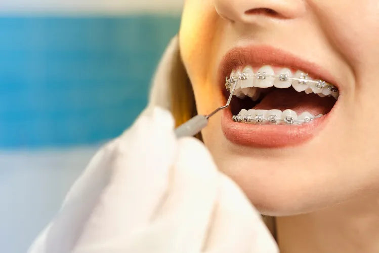 Gros plan sur un contrôle orthodontique