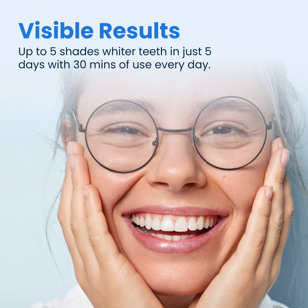 Smart Teeth Whitening Kit